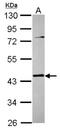 Tropomodulin 3 antibody, NBP2-20731, Novus Biologicals, Western Blot image 