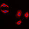 Matrix Metallopeptidase 3 antibody, LS-C352522, Lifespan Biosciences, Immunofluorescence image 