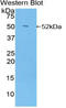 Nuclear Receptor Subfamily 3 Group C Member 1 antibody, abx131109, Abbexa, Western Blot image 