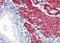 Transgelin antibody, orb18630, Biorbyt, Immunohistochemistry paraffin image 