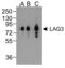 Lymphocyte Activating 3 antibody, RF16088, ProSci, Western Blot image 