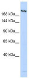 Lysine Demethylase 6B antibody, TA345639, Origene, Western Blot image 