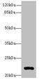 ADP Ribosylation Factor Like GTPase 14 antibody, CSB-PA836664LA01HU, Cusabio, Western Blot image 