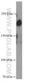 Zinc finger E-box-binding homeobox 1 antibody, 66279-1-Ig, Proteintech Group, Western Blot image 