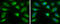 Argininosuccinate Synthase 1 antibody, GTX101325, GeneTex, Immunofluorescence image 