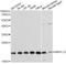 Mitochondrial Ribosomal Protein L13 antibody, A14122, ABclonal Technology, Western Blot image 