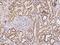 ATP Synthase Peripheral Stalk Subunit OSCP antibody, 200456-T08, Sino Biological, Immunohistochemistry paraffin image 