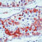 MAGE Family Member A1 antibody, LS-C87417, Lifespan Biosciences, Immunohistochemistry paraffin image 