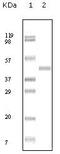 ABL Proto-Oncogene 2, Non-Receptor Tyrosine Kinase antibody, GTX83254, GeneTex, Western Blot image 