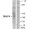 Prostate Transmembrane Protein, Androgen Induced 1 antibody, MBS9413426, MyBioSource, Western Blot image 