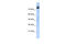 Phospholipase D2 antibody, ARP38182_P050, Aviva Systems Biology, Western Blot image 