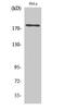 Erb-B2 Receptor Tyrosine Kinase 3 antibody, STJ92977, St John