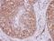 Exportin-6 antibody, PA5-31813, Invitrogen Antibodies, Immunohistochemistry paraffin image 