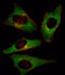 Phosphatidylinositol-4,5-Bisphosphate 3-Kinase Catalytic Subunit Delta antibody, abx033822, Abbexa, Immunohistochemistry paraffin image 