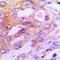 Ribosomal Protein S6 Kinase B1 antibody, LS-C358316, Lifespan Biosciences, Immunohistochemistry paraffin image 