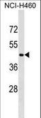 Cytokine Receptor Like Factor 3 antibody, LS-C159407, Lifespan Biosciences, Western Blot image 