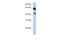 Abhydrolase Domain Containing 16A antibody, 26-433, ProSci, Enzyme Linked Immunosorbent Assay image 