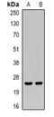 Lymphocyte Antigen 96 antibody, abx225272, Abbexa, Western Blot image 