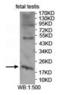 Asparaginase Like 1 antibody, orb309812, Biorbyt, Western Blot image 