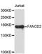 FA Complementation Group D2 antibody, abx126905, Abbexa, Western Blot image 