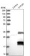 Chromatin Target Of PRMT1 antibody, NBP1-88085, Novus Biologicals, Western Blot image 