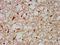 Branched Chain Keto Acid Dehydrogenase E1 Subunit Alpha antibody, LS-C669600, Lifespan Biosciences, Immunohistochemistry paraffin image 