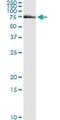 Fanconi anemia group G protein antibody, H00002189-M01, Novus Biologicals, Immunoprecipitation image 