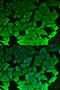 Eukaryotic Elongation Factor 2 Kinase antibody, STJ27357, St John