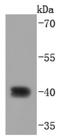 Caudal Type Homeobox 2 antibody, NBP2-66769, Novus Biologicals, Western Blot image 