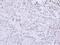 RAD18 E3 Ubiquitin Protein Ligase antibody, PA5-22320, Invitrogen Antibodies, Immunohistochemistry frozen image 