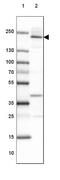 Afadin, Adherens Junction Formation Factor antibody, NBP1-90218, Novus Biologicals, Western Blot image 