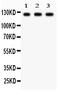 Phospholipase D1 antibody, PB9380, Boster Biological Technology, Western Blot image 