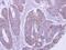 Lactamase Beta 2 antibody, PA5-32043, Invitrogen Antibodies, Immunohistochemistry frozen image 