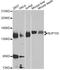 Nucleoporin 155 antibody, A7764, ABclonal Technology, Western Blot image 
