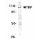 MDM2 Binding Protein antibody, PA1-30558, Invitrogen Antibodies, Western Blot image 