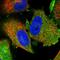 TPD52 Like 1 antibody, HPA027916, Atlas Antibodies, Immunofluorescence image 