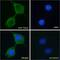 Transient Receptor Potential Cation Channel Subfamily V Member 2 antibody, PA5-18989, Invitrogen Antibodies, Immunofluorescence image 