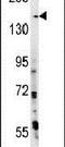 PH Domain And Leucine Rich Repeat Protein Phosphatase 2 antibody, PA5-14908, Invitrogen Antibodies, Western Blot image 