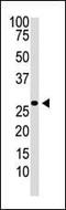 Dickkopf WNT Signaling Pathway Inhibitor 2 antibody, MBS9202296, MyBioSource, Western Blot image 