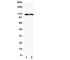 Anoctamin 1 antibody, R31414, NSJ Bioreagents, Western Blot image 