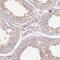 RB1 Inducible Coiled-Coil 1 antibody, NBP2-48572, Novus Biologicals, Immunohistochemistry paraffin image 