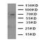 Sodium-dependent serotonin transporter antibody, orb76220, Biorbyt, Western Blot image 