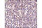 Neurofilament Light antibody, 2835S, Cell Signaling Technology, Immunohistochemistry paraffin image 