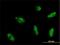 Myocyte Enhancer Factor 2A antibody, H00004205-M02, Novus Biologicals, Immunofluorescence image 