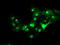 Regulatory Factor X Associated Ankyrin Containing Protein antibody, LS-C173623, Lifespan Biosciences, Immunofluorescence image 