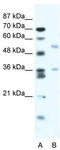 BTB Domain Containing 3 antibody, TA338073, Origene, Western Blot image 