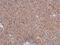 Phosphate Cytidylyltransferase 2, Ethanolamine antibody, NBP2-19735, Novus Biologicals, Immunohistochemistry frozen image 