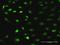 Ribosome Biogenesis Regulator 1 Homolog antibody, H00023212-D01P, Novus Biologicals, Immunocytochemistry image 