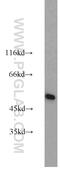 Glutamate dehydrogenase 1, mitochondrial antibody, 14299-1-AP, Proteintech Group, Western Blot image 