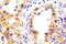 p53 antibody, AP20898PU-N, Origene, Immunohistochemistry paraffin image 